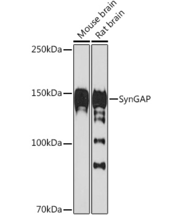 SynGAP Rabbit Monoclonal Antibody