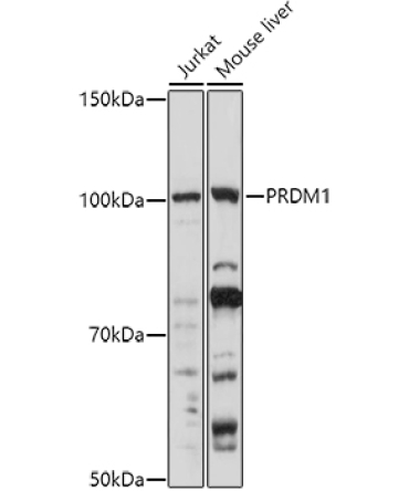 PRDM1 Rabbit Polyclonal Antibody