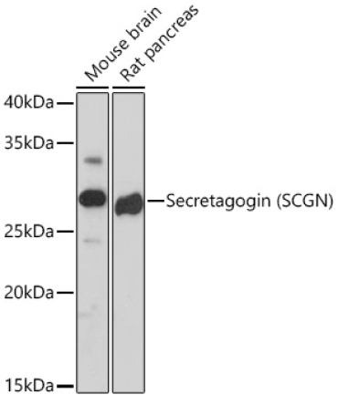 Secretagogin (SCGN) Rabbit Monoclonal Antibody