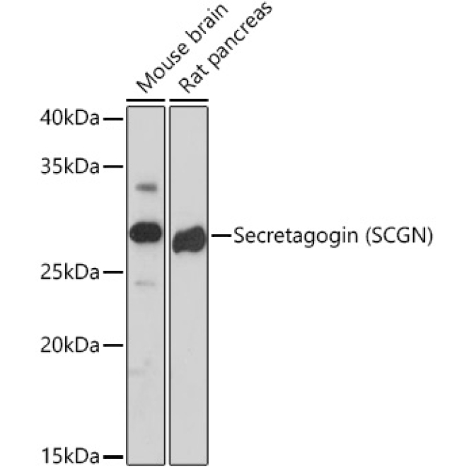 Secretagogin (SCGN) Rabbit Monoclonal Antibody