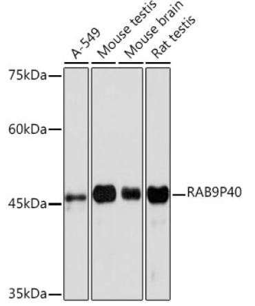 RAB9P40 Rabbit Monoclonal Antibody