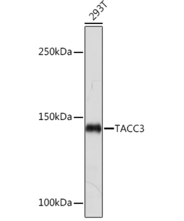 TACC3 Rabbit Monoclonal Antibody