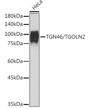 TGN46/TGOLN2 Rabbit Monoclonal Antibody