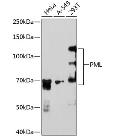 PML Rabbit Monoclonal Antibody