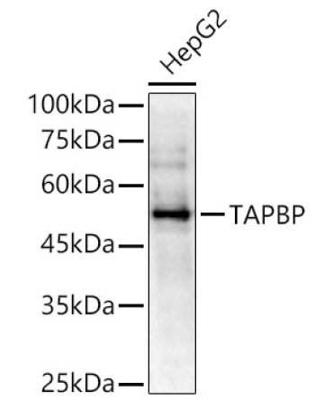 TAPBP Rabbit Polyclonal Antibody
