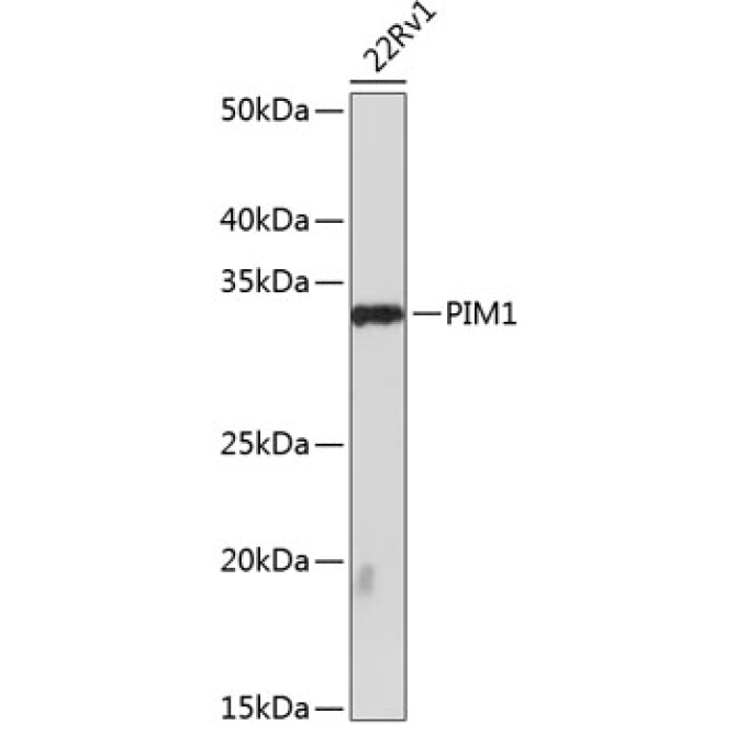 PIM1 Rabbit Monoclonal Antibody