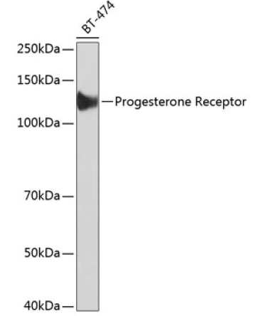 Progesterone Receptor Rabbit Monoclonal Antibody