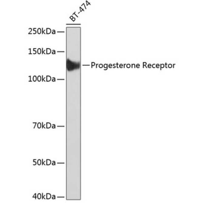 Progesterone Receptor Rabbit Monoclonal Antibody