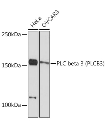 PLC beta 3 (PLCB3) Rabbit Monoclonal Antibody
