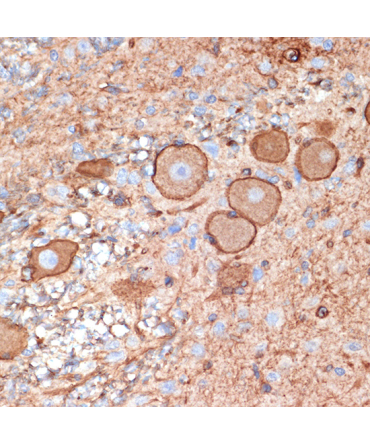 Plectin Rabbit Monoclonal Antibody
