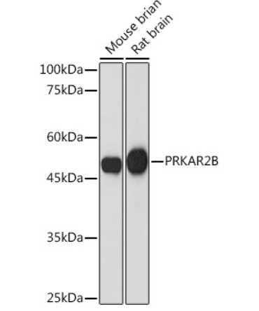 PRKAR2B Rabbit Monoclonal Antibody