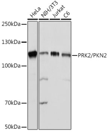 PRK2/PKN2 Rabbit Monoclonal Antibody
