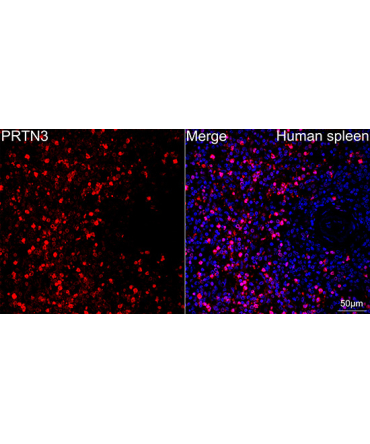 Proteinase 3/PR3 Rabbit Monoclonal Antibody