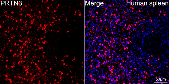 Proteinase 3/PR3 Rabbit Monoclonal Antibody