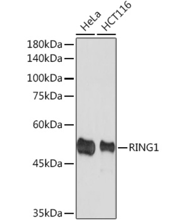 RING1A Rabbit Monoclonal Antibody