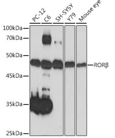RORBeta Rabbit Monoclonal Antibody