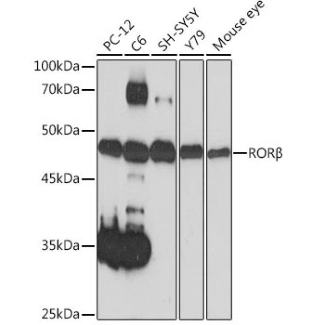 RORBeta Rabbit Monoclonal Antibody