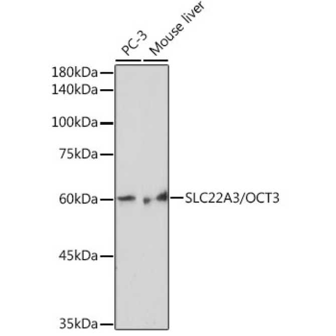 SLC22A3/OCT3 Rabbit Monoclonal Antibody