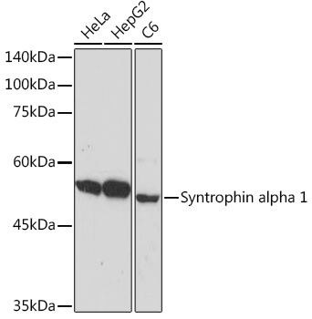 Syntrophin alpha 1 Rabbit Monoclonal Antibody