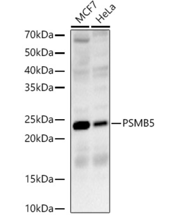 PSMB5 Rabbit Polyclonal Antibody