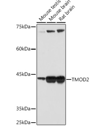TMOD2 Rabbit Monoclonal Antibody