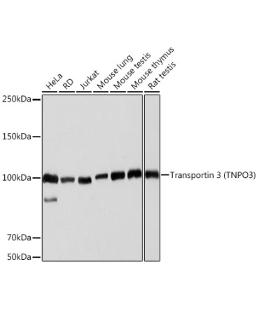 Transportin 3 (TNPO3) Rabbit Monoclonal Antibody