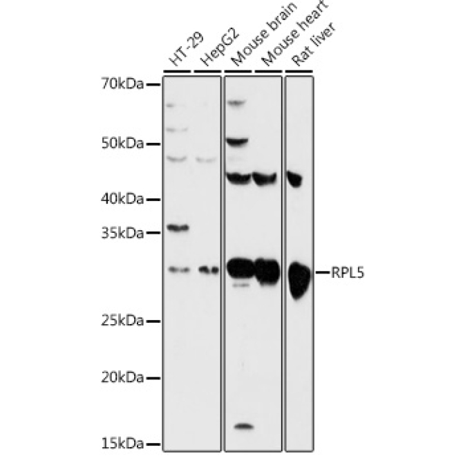 RPL5 Rabbit Polyclonal Antibody