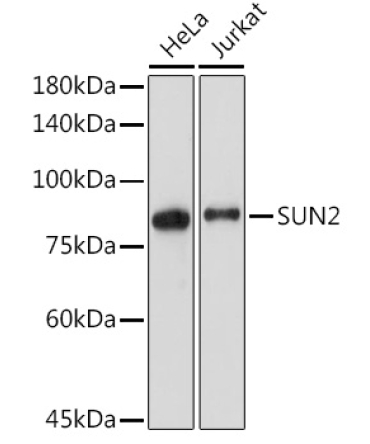 SUN2 Rabbit Monoclonal Antibody