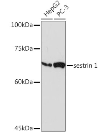 sestrin 1 Rabbit Monoclonal Antibody