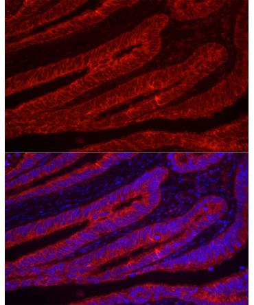TFF3 Rabbit Polyclonal Antibody