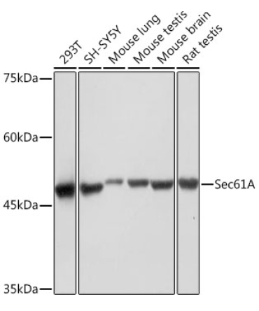 Sec61A Rabbit Monoclonal Antibody
