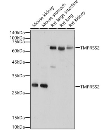 TMPRSS2 Rabbit Polyclonal Antibody