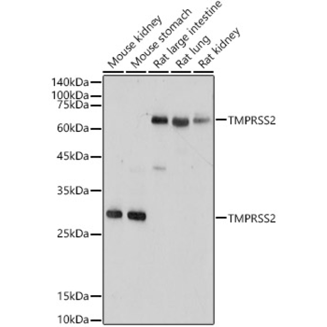 TMPRSS2 Rabbit Polyclonal Antibody