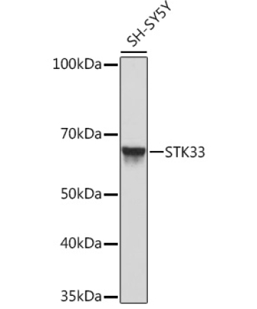 STK33 Rabbit Monoclonal Antibody