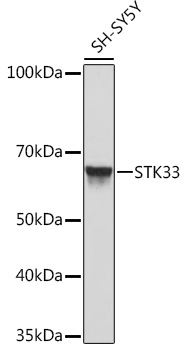 STK33 Rabbit Monoclonal Antibody