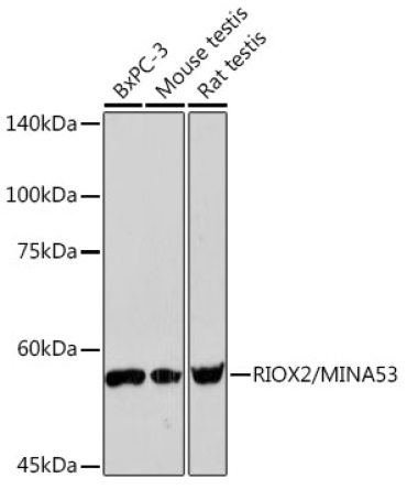 RIOX2/MINA53 Rabbit Monoclonal Antibody
