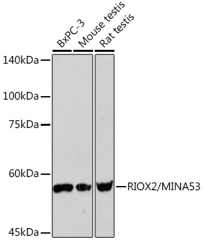 RIOX2/MINA53 Rabbit Monoclonal Antibody