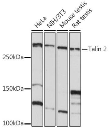 Talin 2 Rabbit Monoclonal Antibody