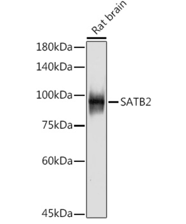 SATB2 Rabbit Monoclonal Antibody