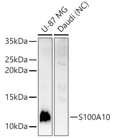 S100A10 Rabbit Polyclonal Antibody