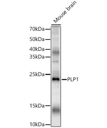 PLP1 Rabbit Polyclonal Antibody