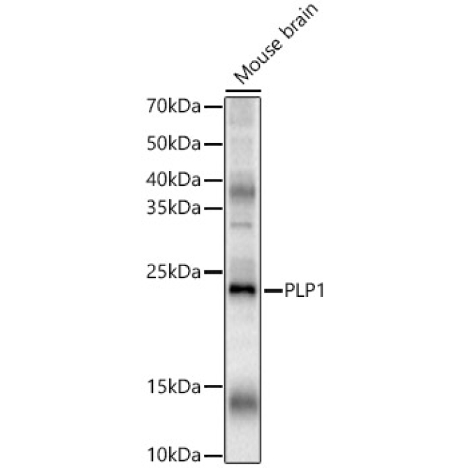 PLP1 Rabbit Polyclonal Antibody