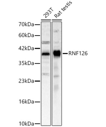 RNF126 Rabbit Polyclonal Antibody