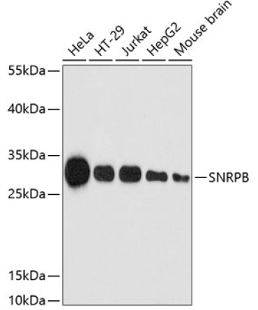 SNRPB Rabbit Polyclonal Antibody