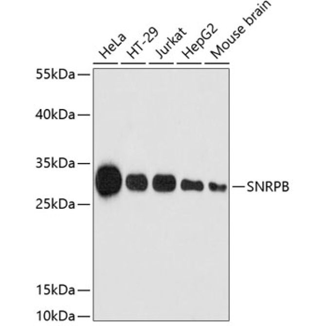SNRPB Rabbit Polyclonal Antibody