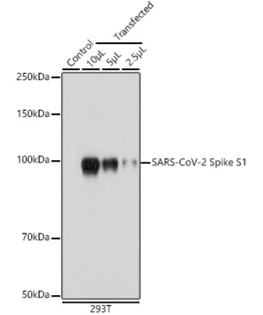 SARS-CoV-2 Spike S1 Rabbit Polyclonal Antibody