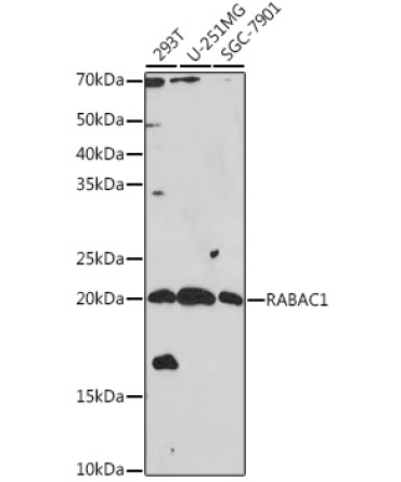 RABAC1 Rabbit Polyclonal Antibody
