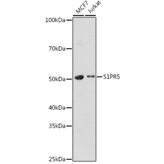 S1PR5 Rabbit Polyclonal Antibody