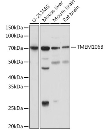 TMEM106B Rabbit Polyclonal Antibody
