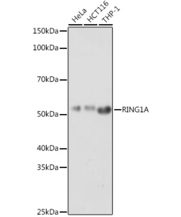 RING1A Rabbit Polyclonal Antibody